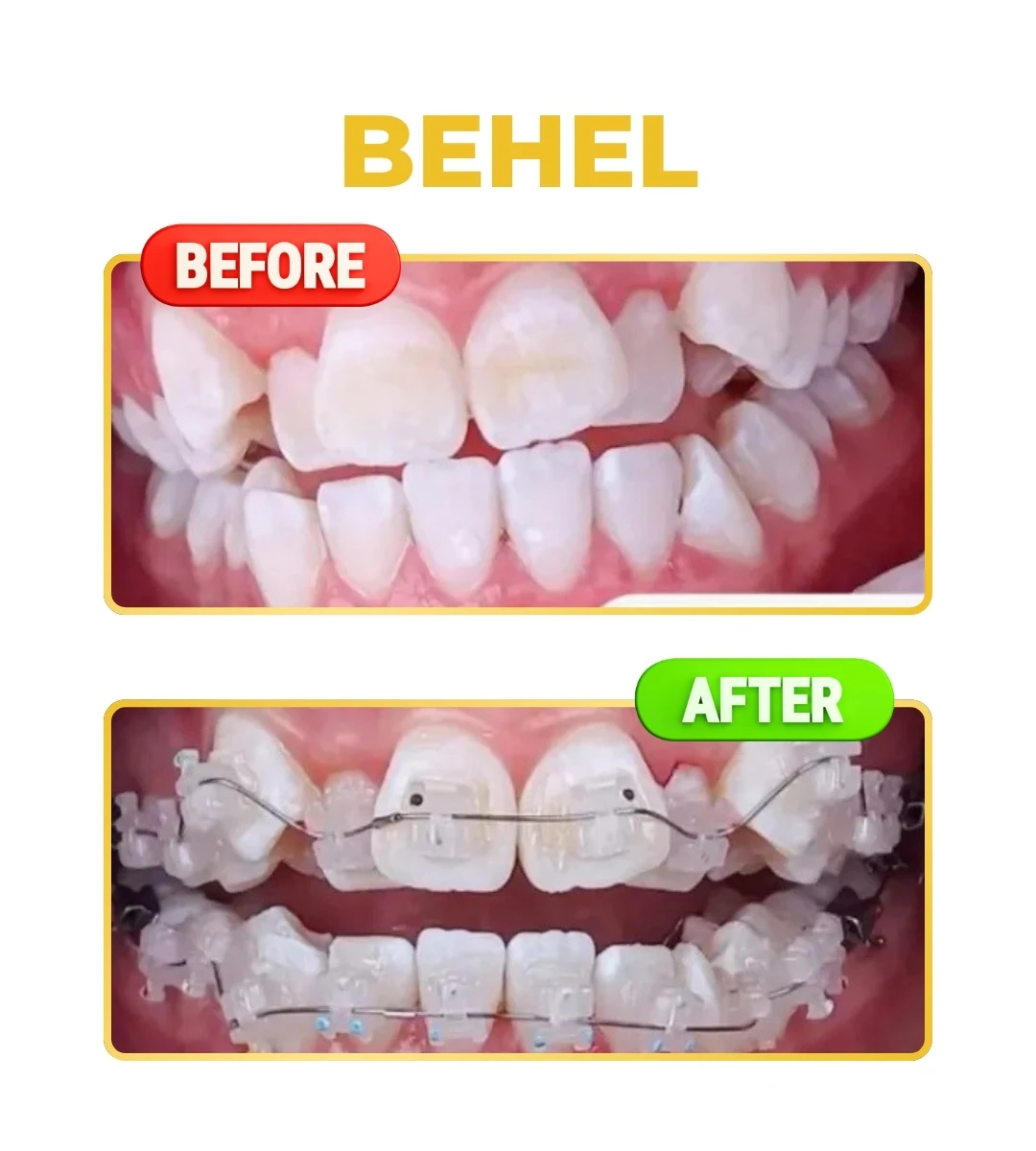 Behel