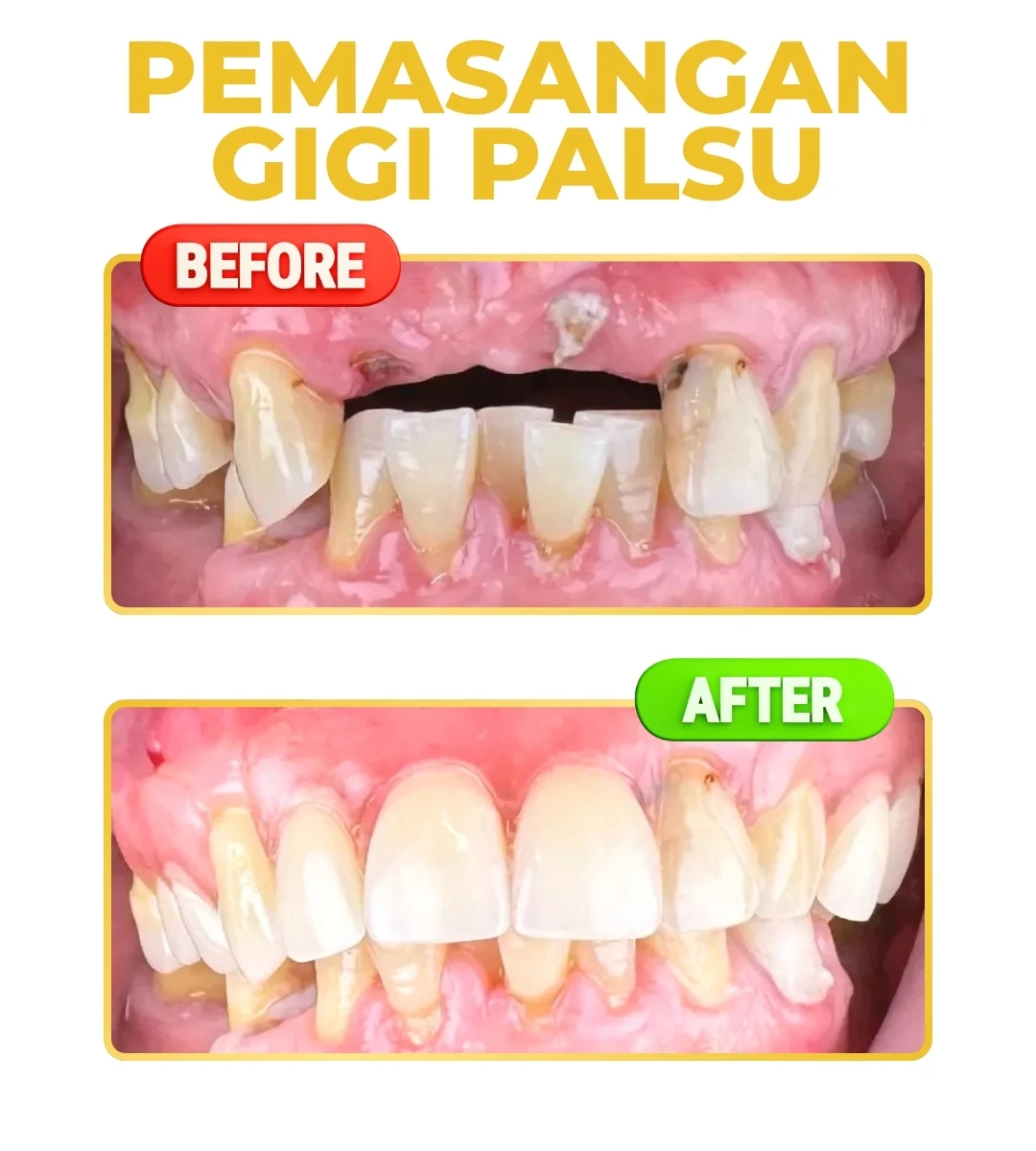 Dokter gigi Tangerang sedang melakukan perawatan gigi cabut gigi dan tambal gigi di Daven Dental Pasar Kemis